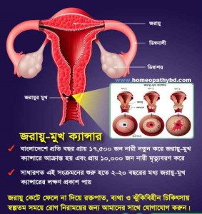 জরায়ু ক্যান্সারের কথা Jorayu Cancer Bangla Helth Tips
