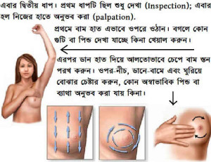 Breast Exam bse step 2