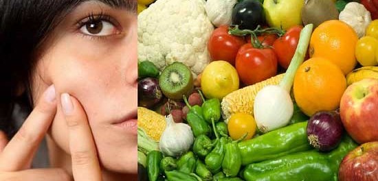 ব্রণ সমস্যা চিরতরে দূর করবে যে ৬টি খাবার || Mukher Bron Dur Korar Upai