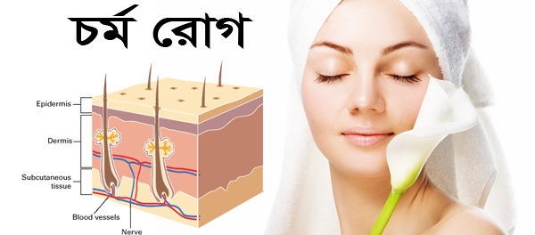 চর্ম রোগের হোমিওপ্যাথি চিকিৎসা Cormo Roger Homio Cikitsa